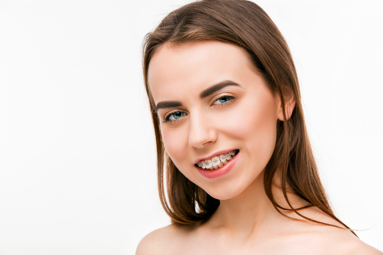 beautiful young woman with teeth braces tabitha