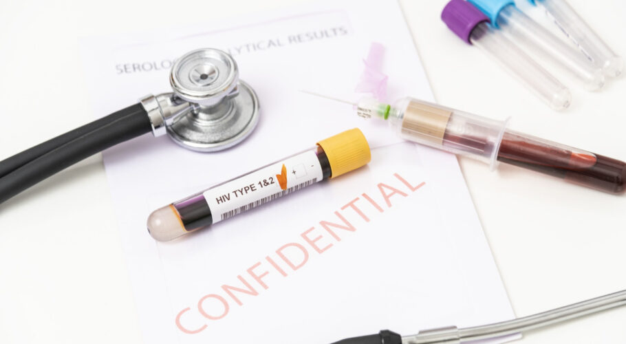 close up positive blood sample from